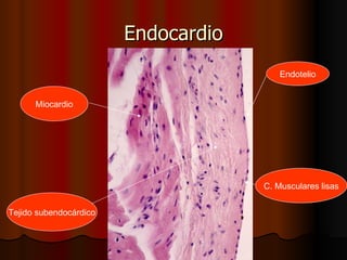Endocardio
                                         Endotelio


      Miocardio




                                     C. Musculares lisas


Tejido subendocárdico
 