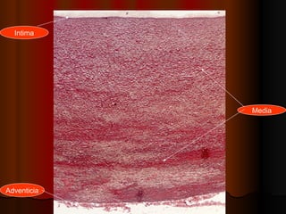 Intima




             Media




Adventicia
 