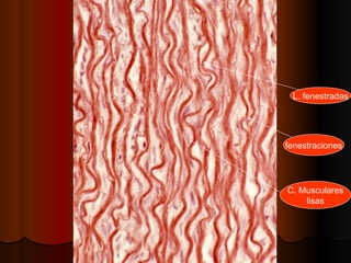 L. fenestradas




fenestraciones




C. Musculares
    lisas
 