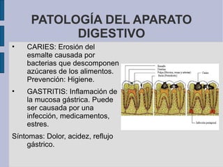 PATOLOGÍA DEL APARATO
DIGESTIVO
• CARIES: Erosión del
esmalte causada por
bacterias que descomponen
azúcares de los alimentos.
Prevención: Higiene.
• GASTRITIS: Inflamación de
la mucosa gástrica. Puede
ser causada por una
infección, medicamentos,
estres.
Síntomas: Dolor, acidez, reflujo
gástrico.
 