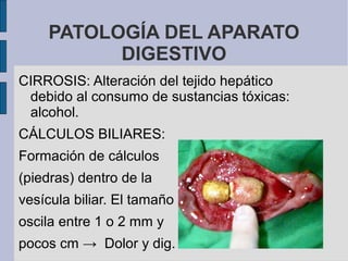 PATOLOGÍA DEL APARATO
DIGESTIVO
CIRROSIS: Alteración del tejido hepático
debido al consumo de sustancias tóxicas:
alcohol.
CÁLCULOS BILIARES:
Formación de cálculos
(piedras) dentro de la
vesícula biliar. El tamaño
oscila entre 1 o 2 mm y
pocos cm → Dolor y dig.
 