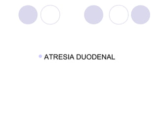  ATRESIA

DUODENAL

 