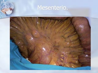 Mesenterio. 
 