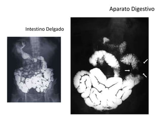 Aparato Digestivo
Intestino Delgado
 