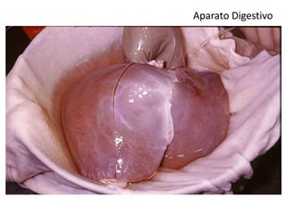 Aparato Digestivo
Hígado
 