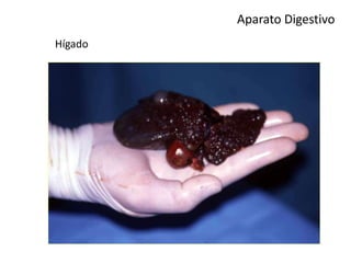 Aparato Digestivo
Hígado
 