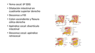 • Yema cecal: 6ª SDG
• Dilatación intestinal en
cuadrante superior derecho
• Descenso a FID
• Colon ascendente y flexura
cólica derecha
• Apéndice cecal: divertículo
intestinal
• Descenso cecal: apéndice
retrocecal
 