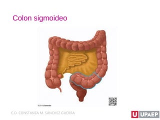 Colon sigmoideo
C.D. CONSTANZA M. SÁNCHEZ GUERRA
 