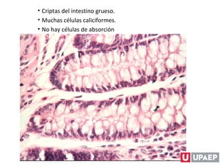 • Criptas del intestino grueso.
• Muchas células caliciformes.
• No hay células de absorción
 