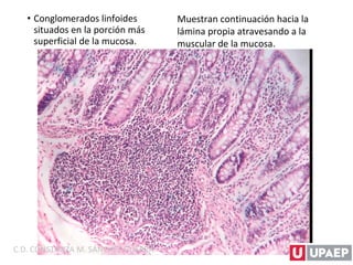 • Conglomerados linfoides
situados en la porción más
superficial de la mucosa.
Muestran continuación hacia la
lámina propia atravesando a la
muscular de la mucosa.
C.D. CONSTANZA M. SÁNCHEZ GUERRA
 