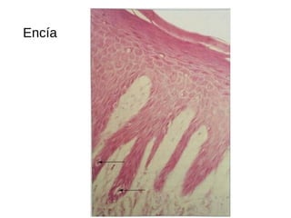 Encía
 