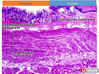 Estómago Esófago
 