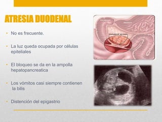 ATRESIA DUODENAL 
• No es frecuente. 
• La luz queda ocupada por células 
epiteliales 
• El bloqueo se da en la ampolla 
hepatopancreatica 
• Los vómitos casi siempre contienen 
la bilis 
• Distención del epigastrio 
 