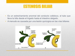 ESTENOSIS BILIAR 
• Es un estrechamiento anormal del conducto colédoco, el tubo que 
lleva la bilis desde el hígado hasta el intestino delgado. 
• A menudo es causada por una lesión quirúrgica en las vías biliares 
 