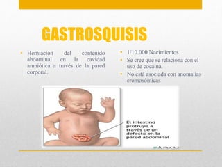 GASTROSQUISIS 
• Herniación del contenido 
abdominal en la cavidad 
amniótica a través de la pared 
corporal. 
• 1/10.000 Nacimientos 
• Se cree que se relaciona con el 
uso de cocaína. 
• No está asociada con anomalías 
cromosómicas 
 