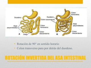 • Rotación de 90° en sentido horario 
• Colon transverso para por detrás del duodeno. 
ROTACIÓN INVERTIDA DEL ASA INTESTINAL 
 