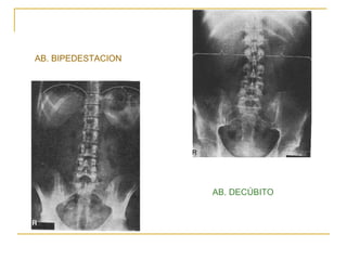 AB. BIPEDESTACION AB. DECÚBITO 