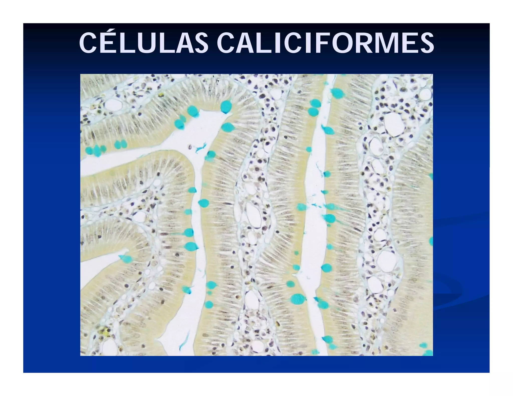 CÉLULAS CALICIFORMES

 