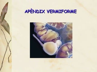 AP È NDIX VERMIFORME 