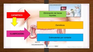 CATARTICO:
Eliminación de heces
líquidas.
CLASIFICACION:
Osmóticos
Estimulantes por contacto
 