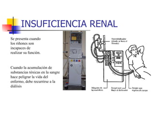 INSUFICIENCIA RENAL Se presenta cuando los riñones son incapaces de realizar su función.   Cuando la acumulación de substancias tóxicas en la sangre hace peligrar la vida del enfermo, debe recurrirse a la diálisis   