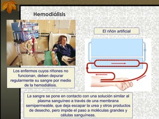 Hemodiálisis
El riñón artificial

Los enfermos cuyos riñones no
funcionan, deben depurar
regularmente su sangre por medio
de la hemodiálisis.
La sangre se pone en contacto con una solución similar al
plasma sanguíneo a través de una membrana
semipermeable, que deja escapar la urea y otros productos
de desecho, pero impide el paso a moléculas grandes y
células sanguíneas.

 
