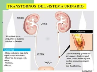 TRANSTORNOS DEL SISTEMA URINARIO 
 
