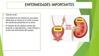  Cálculo renal
 Una piedra en los riñones es una pieza
sólida que se forma en el riñón a causa
de sustancias presentes en la orina.
 El tamaño de las piedras variará de
acuerdo a cada persona, y esto influye a
la hora de eliminarlas del cuerpo.
ENFERMEDADES IMPORTANTES
 