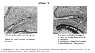 -el fórnix conjuntival superior se engrosa.
-Queda una zona intermedia con ausencia
de células.
-El engrosamiento epitelial adopta la
forma de una agrupación de células de
forma nodular.
-El mesénquima rodea el fónix superior,
formando un ovoide. Área glandular.
de la Cuadra-Blanco C, Peces-Peña MD, Mérida-Velasco JR. Morphogenesis of the human lacrimal gland. J Anat. 2003 Nov;203(5):531-6. doi:
10.1046/j.1469-7580.2003.00233.x. PMID: 14635806; PMCID: PMC1571187.
SEMANA 7 Y 8
 
