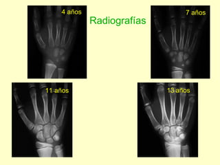 4 años 7 años 11 años 13   años Radiografías 