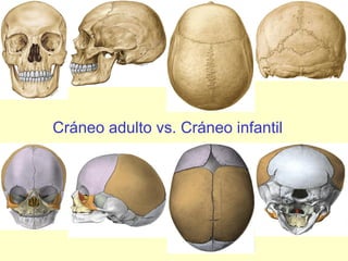 Cráneo adulto vs. Cráneo infantil 