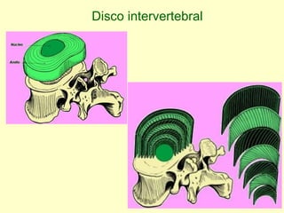 Disco intervertebral 