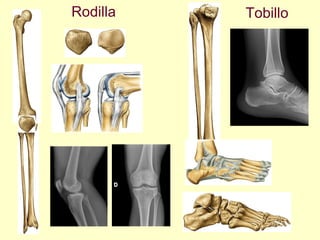 Rodilla Tobillo 