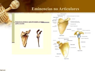 Eminencias no Articulares
 