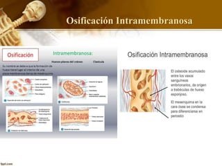 Osificación Intramembranosa
 