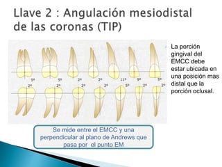  La porción
gingival del
EMCC debe
estar ubicada en
una posición mas
distal que la
porción oclusal.
Se mide entre el EMCC y una
perpendicular al plano de Andrews que
pasa por el punto EM
 