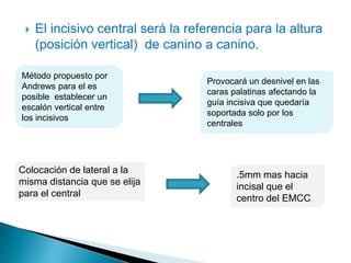  El incisivo central será la referencia para la altura
(posición vertical) de canino a canino.
Método propuesto por
Andrews para el es
posible establecer un
escalón vertical entre
los incisivos
Provocará un desnivel en las
caras palatinas afectando la
guía incisiva que quedaría
soportada solo por los
centrales
Colocación de lateral a la
misma distancia que se elija
para el central
.5mm mas hacia
incisal que el
centro del EMCC
 
