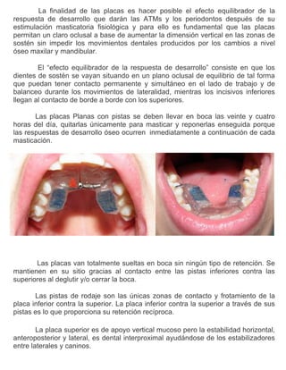 Aparatología RNO 2: Placas Planas con pistas de rodaje o indirectas. | PDF