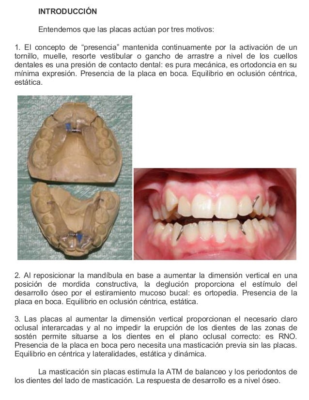 Duele la garganta y el cuello que esto
