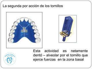 La segunda por acción de los tornillos




                   Esta actividad es netamente
                   dentó – alveolar por el tornillo que
                   ejerce fuerzas en la zona basal
 