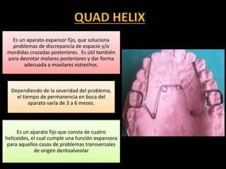 QUAD HELIX
Es un aparato expansor fijo, que soluciona
problemas de discrepancia de espacio y/o
mordidas cruzadas posteriores. Es útil también
para desrotar molares posteriores y dar forma
adecuada a maxilares estrechos.
Dependiendo de la severidad del problema,
el tiempo de permanencia en boca del
aparato varía de 3 a 6 meses.
Es un aparato fijo que consta de cuatro
helicoides, el cual cumple una función expansora
para aquellos casos de problemas transversales
de origen dentoalveolar
 