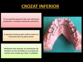 CROZAT INFERIOR
Es un aparato expansor fijo, que soluciona
problemas maxilares inferiores estrechos.
El aparato Crozat puede realizar todas las
funciones de una placa activa
Mediante este aparato, los elementos de
alambre no son anclados en una base de
acrílico sino unidos por láser o soldados
 