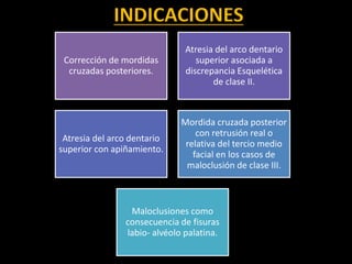 INDICACIONES
Corrección de mordidas
cruzadas posteriores.
Atresia del arco dentario
superior asociada a
discrepancia Esquelética
de clase II.
Atresia del arco dentario
superior con apiñamiento.
Mordida cruzada posterior
con retrusión real o
relativa del tercio medio
facial en los casos de
maloclusión de clase III.
Maloclusiones como
consecuencia de fisuras
labio- alvéolo palatina.
 