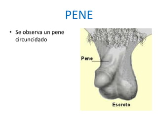PENE
• Se observa un pene
circuncidado
 
