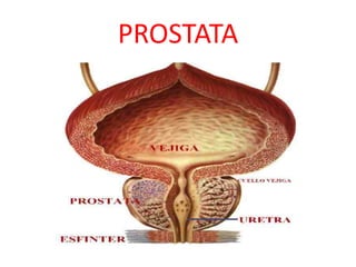 PROSTATA
 