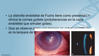 • La distrofia endotelial de Fuchs tiene como presentaci.n
clínica la cornea guttata (protuberancias en la capa
endotelial que simulan gotas).
• Que se observa como una imagen en cobre amartillado
en la lampara de hendidura.
 