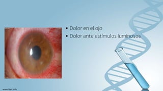 • Dolor en el ojo
• Dolor ante estímulos luminosos
 