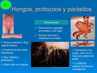 86

          Hongos, protozoos y parásitos

                                    Tricomoniasis

                          ...