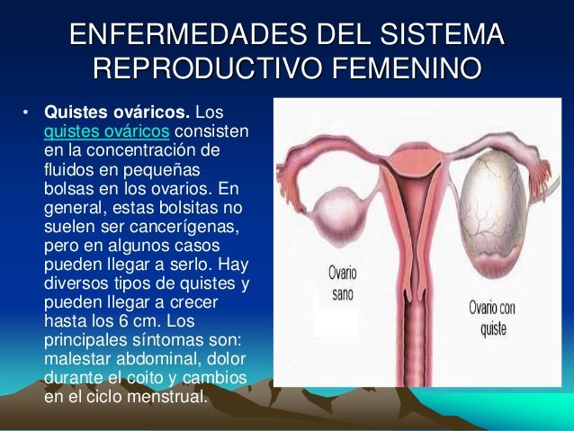 Aparato reproductor