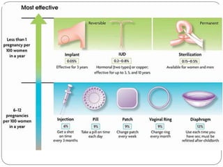 Aparato reproductor.
